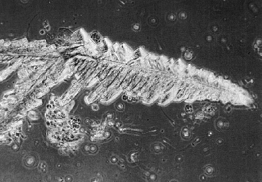 粪沉渣怎么取最新资料整理的尿检图谱：36张图片手把手教你辨认尿液中的鸟粪石结晶_https://www.jmylbn.com_新闻资讯_第38张