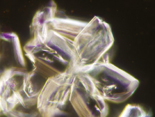 粪沉渣怎么取最新资料整理的尿检图谱：36张图片手把手教你辨认尿液中的鸟粪石结晶_https://www.jmylbn.com_新闻资讯_第28张