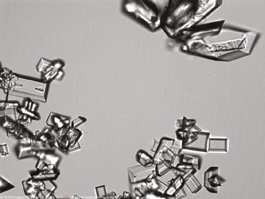 粪沉渣怎么取最新资料整理的尿检图谱：36张图片手把手教你辨认尿液中的鸟粪石结晶_https://www.jmylbn.com_新闻资讯_第10张