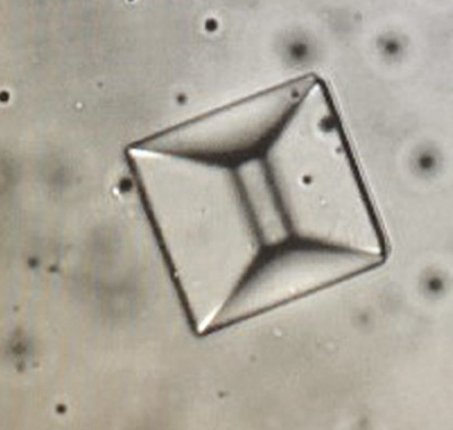 粪沉渣怎么取最新资料整理的尿检图谱：36张图片手把手教你辨认尿液中的鸟粪石结晶_https://www.jmylbn.com_新闻资讯_第8张
