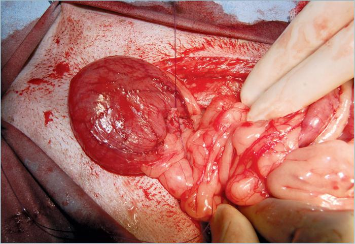 为什么要结扎血管外科实用技术图谱：23张图片详解卵巢子宫切除术的操作要点_https://www.jmylbn.com_新闻资讯_第23张