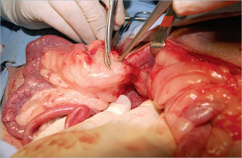 为什么要结扎血管外科实用技术图谱：23张图片详解卵巢子宫切除术的操作要点_https://www.jmylbn.com_新闻资讯_第12张