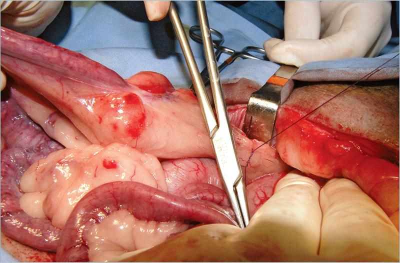 为什么要结扎血管外科实用技术图谱：23张图片详解卵巢子宫切除术的操作要点_https://www.jmylbn.com_新闻资讯_第11张