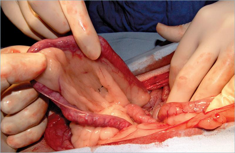 为什么要结扎血管外科实用技术图谱：23张图片详解卵巢子宫切除术的操作要点_https://www.jmylbn.com_新闻资讯_第6张