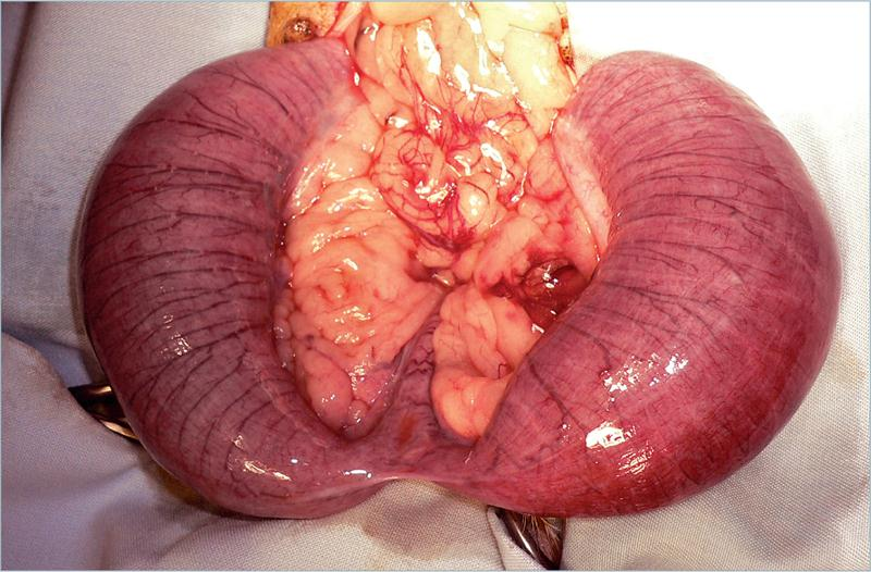 为什么要结扎血管外科实用技术图谱：23张图片详解卵巢子宫切除术的操作要点_https://www.jmylbn.com_新闻资讯_第3张