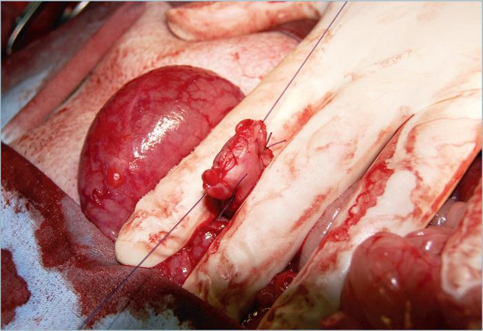 为什么要结扎血管外科实用技术图谱：23张图片详解卵巢子宫切除术的操作要点_https://www.jmylbn.com_新闻资讯_第24张
