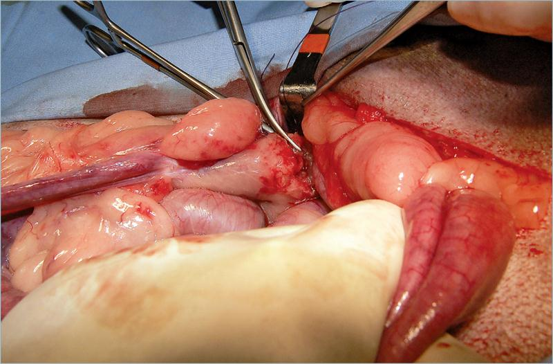 为什么要结扎血管外科实用技术图谱：23张图片详解卵巢子宫切除术的操作要点_https://www.jmylbn.com_新闻资讯_第9张