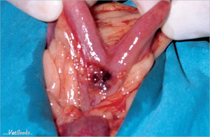 为什么要结扎血管外科实用技术图谱：23张图片详解卵巢子宫切除术的操作要点_https://www.jmylbn.com_新闻资讯_第4张