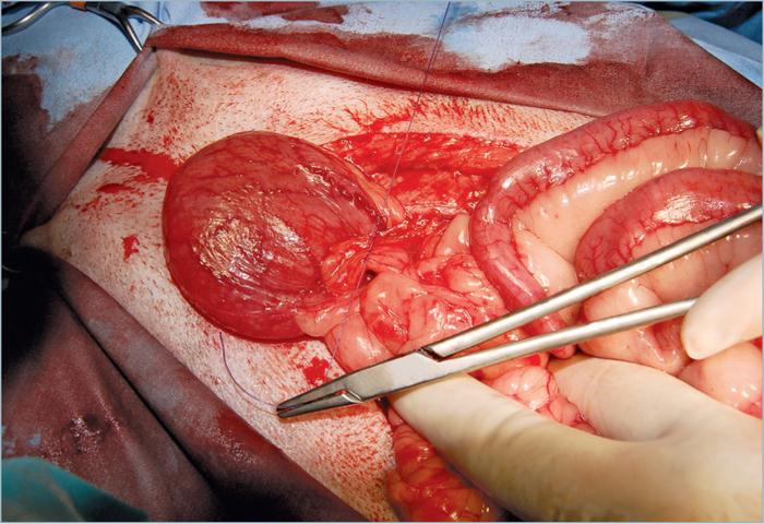 为什么要结扎血管外科实用技术图谱：23张图片详解卵巢子宫切除术的操作要点_https://www.jmylbn.com_新闻资讯_第25张