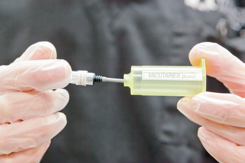 怎么用采血器采血血液学必知之采血器械和常用采血部位_https://www.jmylbn.com_新闻资讯_第5张