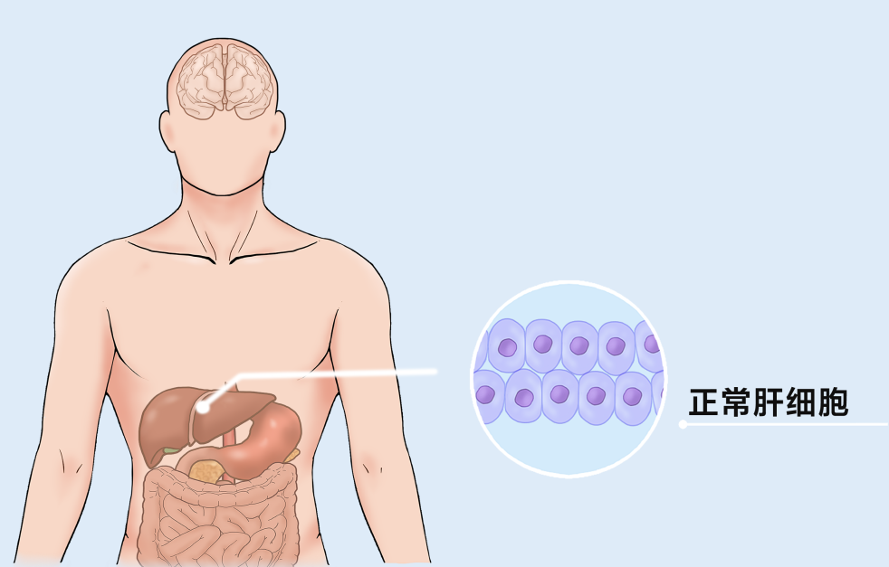 困扰两亿国人！年轻健壮的肝是怎么一步步坏掉的？
