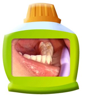 口腔百科丨认识0-6岁宝宝的小乳牙