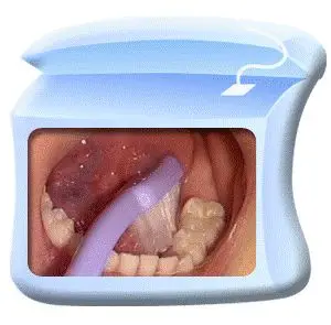 口腔百科丨认识0-6岁宝宝的小乳牙