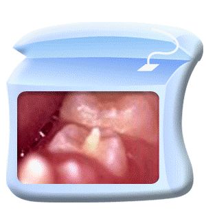 口腔百科丨你家娃的牙齿怎么就“风中凌乱”了？