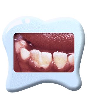 口腔百科丨你家娃的牙齿怎么就“风中凌乱”了？