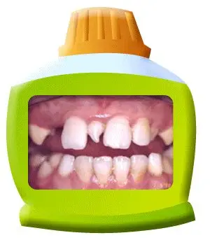 口腔百科丨你家娃的牙齿怎么就“风中凌乱”了？