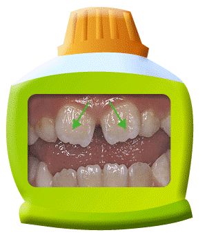 换牙不怂丨丑小鸭期的牙齿怎么护理？