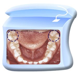 换牙不怂丨丑小鸭期的牙齿怎么护理？