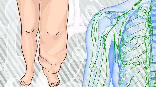 压力绷带为什么那么贵警惕这种“肿”！不敢乱运动！_https://www.jmylbn.com_新闻资讯_第3张