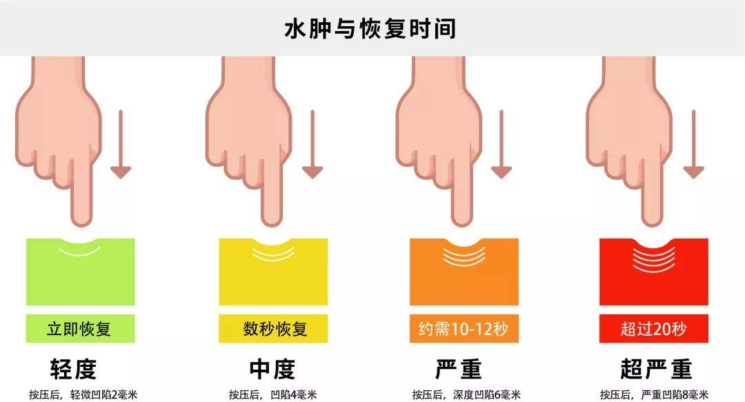 压力绷带为什么那么贵警惕这种“肿”！不敢乱运动！_https://www.jmylbn.com_新闻资讯_第5张
