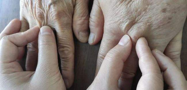 压力绷带为什么那么贵警惕这种“肿”！不敢乱运动！_https://www.jmylbn.com_新闻资讯_第6张