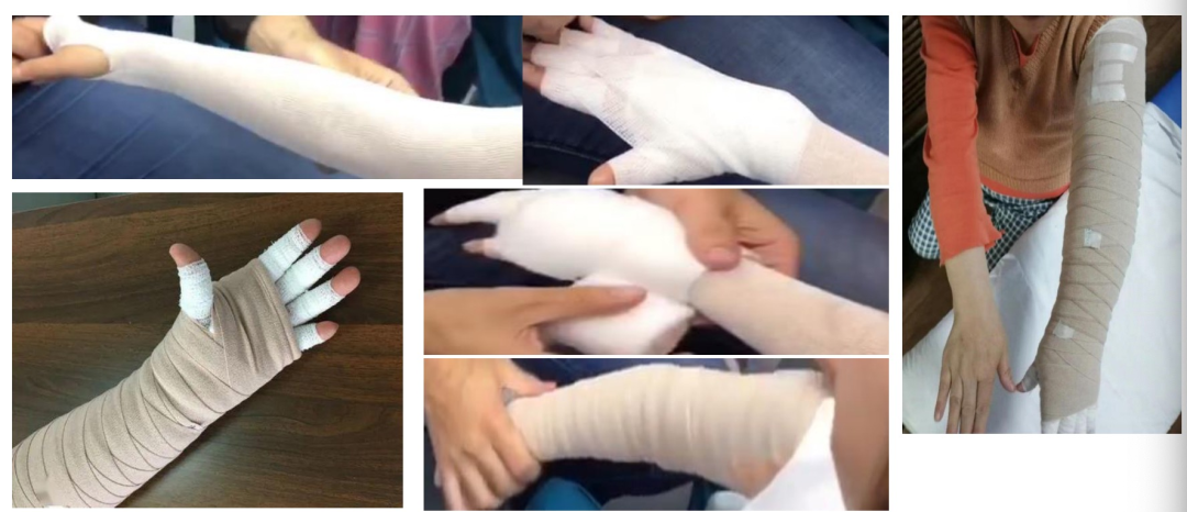 压力绷带为什么那么贵警惕这种“肿”！不敢乱运动！_https://www.jmylbn.com_新闻资讯_第7张