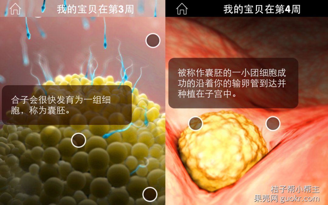 懷孕需要改變什麼—（13）X光片和CT 親子 第5張