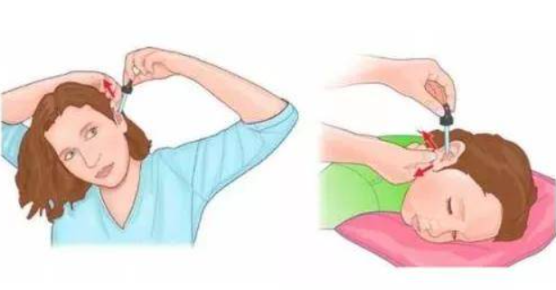 BE药片治什么作用把药片扔进嘴巴里后，来一个潇洒帅气的“猛抬头”？这可不是正确的吃药方式_https://www.jmylbn.com_新闻资讯_第7张