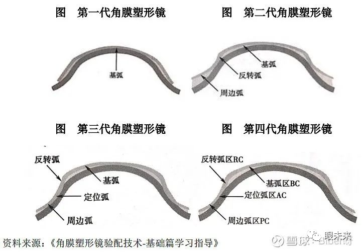 眼科耗材怎么分类一文概览 ｜ 眼科医疗耗材赛道_https://www.jmylbn.com_新闻资讯_第3张
