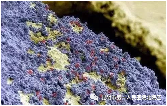 喷砂洁牙机怎么打开【甘美科普】喷砂洁牙，你知道吗？_https://www.jmylbn.com_新闻资讯_第1张