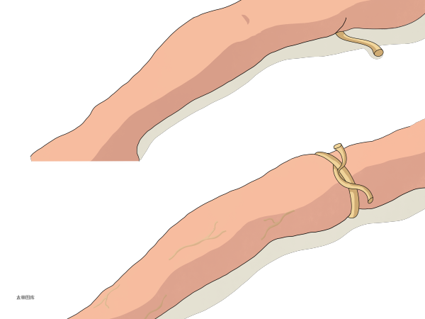 加压输液什么意思护士忘解止血带致病人死亡！输液中存在的12项违法问题护士必须掌握_https://www.jmylbn.com_新闻资讯_第4张