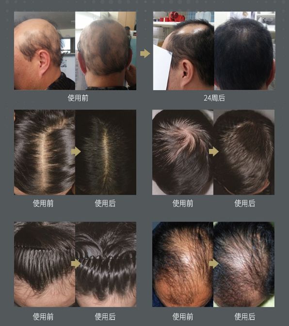 她这次真是从头输到尾 柳飘飘了吗 微信公众号文章阅读 Wemp