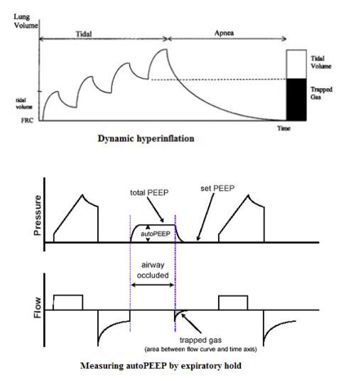 呼吸机数值怎么认不同疾病状态下的呼吸机设置_https://www.jmylbn.com_新闻资讯_第3张