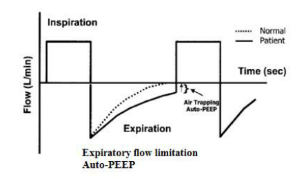 呼吸机数值怎么认不同疾病状态下的呼吸机设置_https://www.jmylbn.com_新闻资讯_第4张