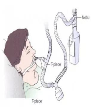 热湿装置怎么安装＜转载＞如何给气管切开患者选择合适的湿化装置？_https://www.jmylbn.com_新闻资讯_第9张