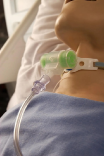 热湿装置怎么安装＜转载＞如何给气管切开患者选择合适的湿化装置？_https://www.jmylbn.com_新闻资讯_第12张