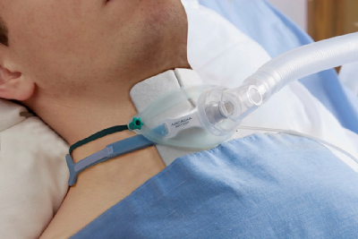 热湿装置怎么安装＜转载＞如何给气管切开患者选择合适的湿化装置？_https://www.jmylbn.com_新闻资讯_第6张