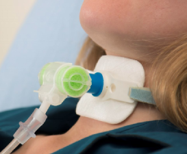 热湿装置怎么安装＜转载＞如何给气管切开患者选择合适的湿化装置？_https://www.jmylbn.com_新闻资讯_第3张