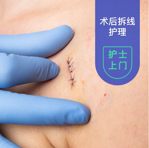 手术后一般多少天拆线 护士上门拆线可以吗 护士上门输液 护士上门打针 护上门换药 微护士