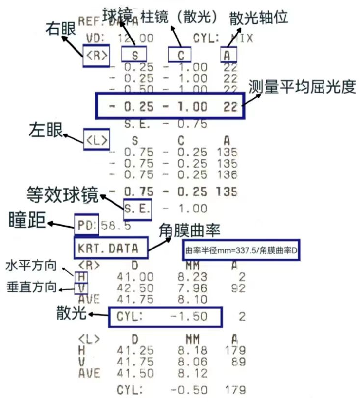 爱护眼睛近视防控不可忽视教你读懂孩子的视力筛查报告单