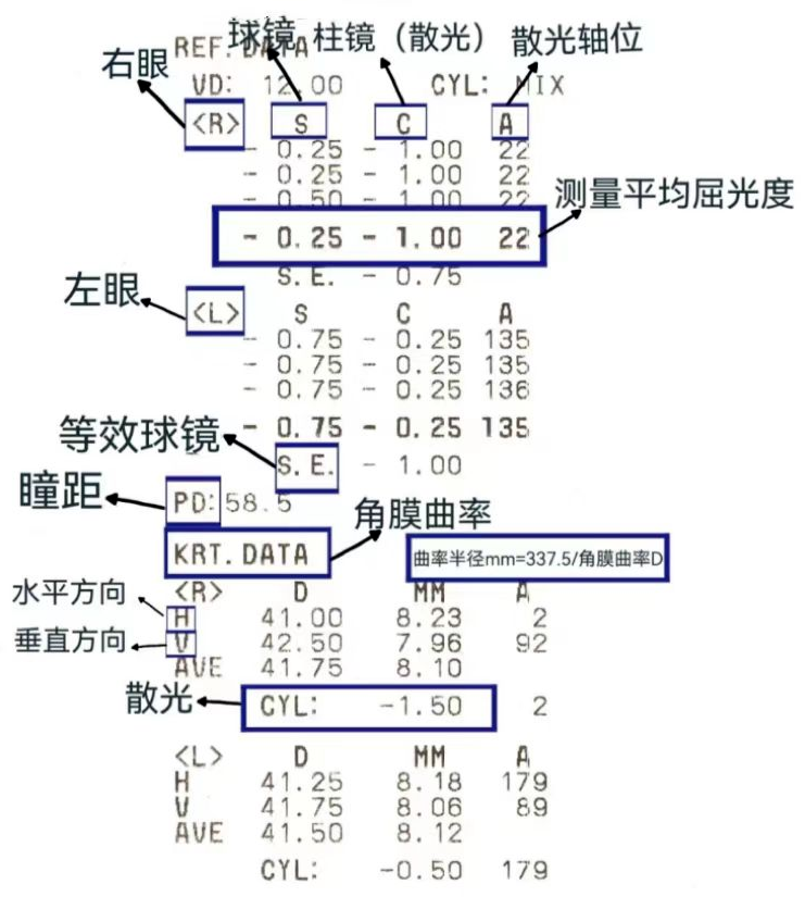 眼科oct检查报告怎么看图片