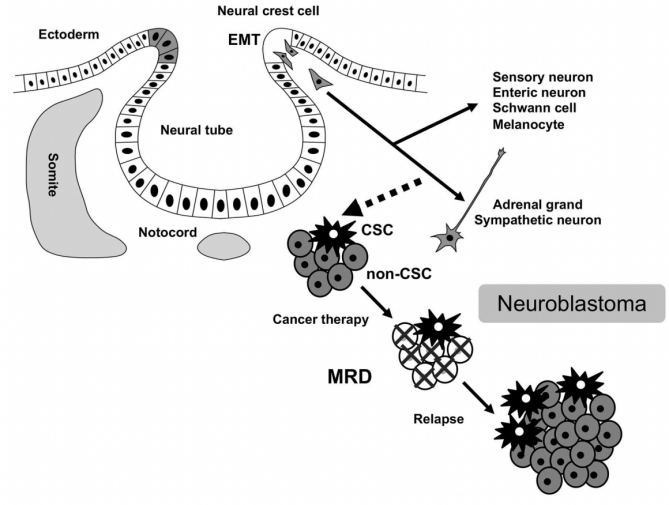 bm细胞是什么细胞Pediatric Blood & Cancer ｜ 微小残留病灶（MRD）——神经母细胞瘤患者_https://www.jmylbn.com_新闻资讯_第2张