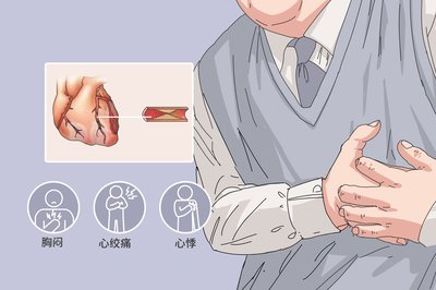 动态心电图机怎么用【健康科普】带您了解24小时动态心电图_https://www.jmylbn.com_新闻资讯_第2张