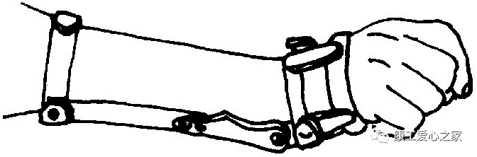 下肢关节康复器怎么用康复科普｜腕手矫形器在工伤康复中的应用_https://www.jmylbn.com_新闻资讯_第19张