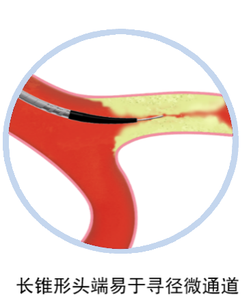 为什么要用到微导管无微不至，游刃有余的微导管_https://www.jmylbn.com_新闻资讯_第19张
