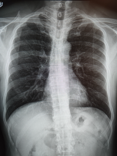 悬吊DR怎么安装放射科再添“利器”｜我院引进一台悬吊式无线双板电动DR拍片设备_https://www.jmylbn.com_新闻资讯_第8张