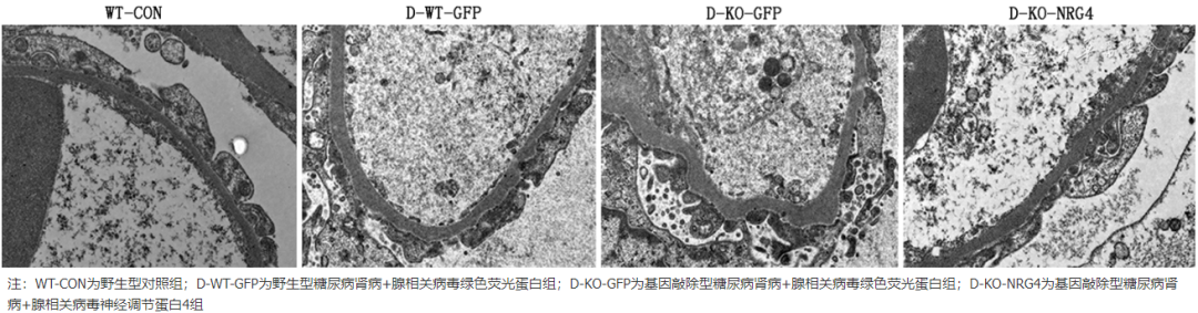 怎么使实验小鼠升血压【论著】棕色脂肪源性神经调节蛋白4对糖尿病肾病小鼠炎症保护作用的研究_https://www.jmylbn.com_新闻资讯_第7张