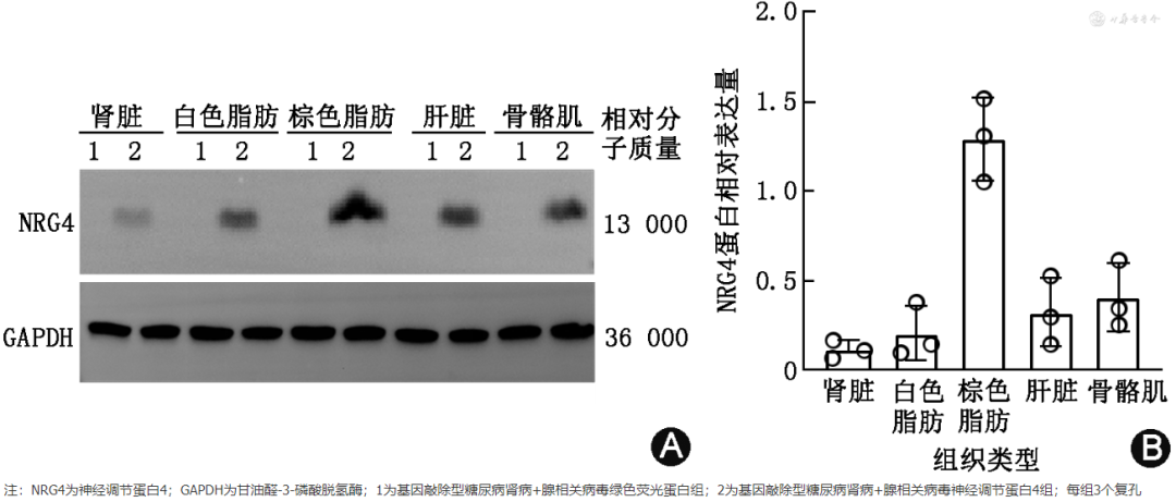 怎么使实验小鼠升血压【论著】棕色脂肪源性神经调节蛋白4对糖尿病肾病小鼠炎症保护作用的研究_https://www.jmylbn.com_新闻资讯_第11张