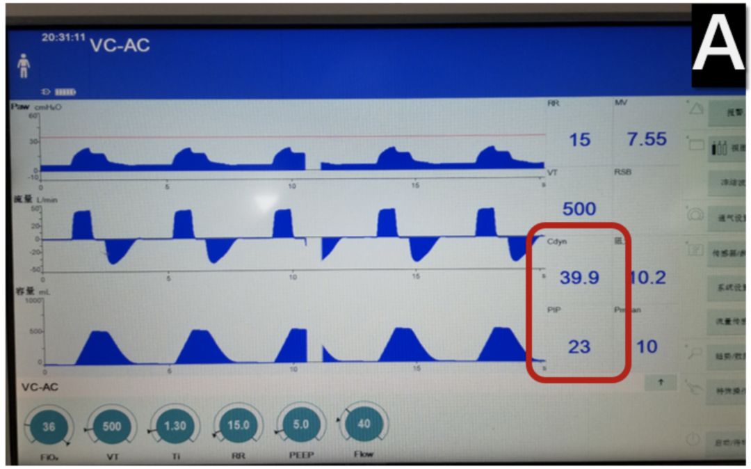吸痰装置怎么连接【诊疗方案】新型冠状病毒感染重型及危重型患者呼吸治疗相关操作防护措施专家共识_https://www.jmylbn.com_新闻资讯_第11张