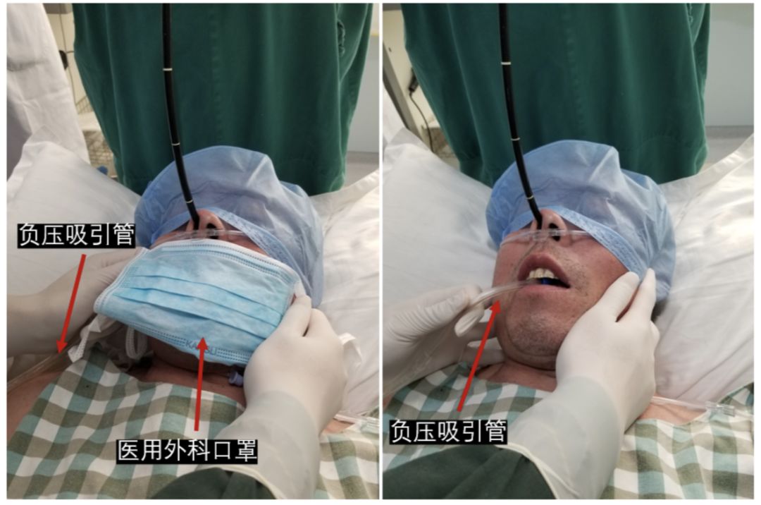 吸痰装置怎么连接【诊疗方案】新型冠状病毒感染重型及危重型患者呼吸治疗相关操作防护措施专家共识_https://www.jmylbn.com_新闻资讯_第7张